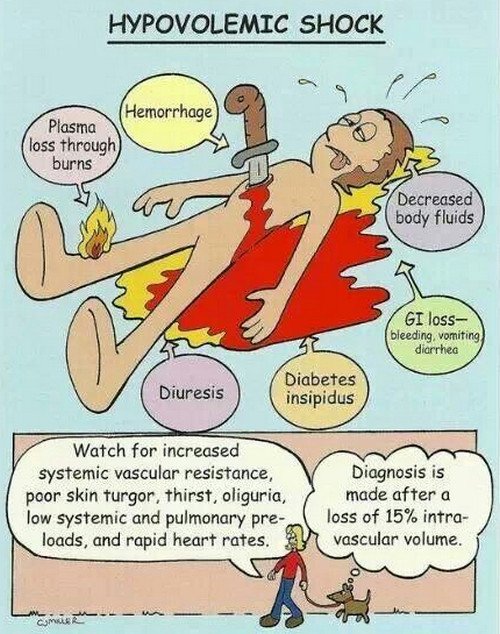 Causes, Symptoms & Signs of Hypovolemia.photo