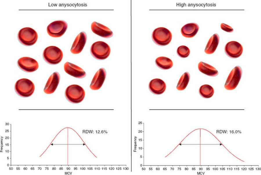 high and low Anisocytosis smear picture