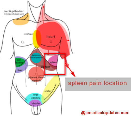 spleen abdomen pain location