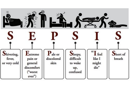 Clinical features of sepsis image picture photo