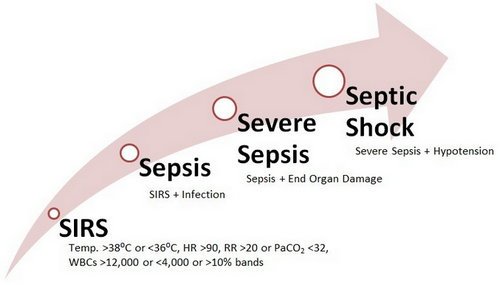 Stages of sepsis image photo picture
