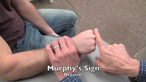 Murphy’s sign in this case is negative as you can see the middle knuckle is not at the same level of its neighbours