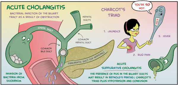 Pathogenesis of ascending cholangitis