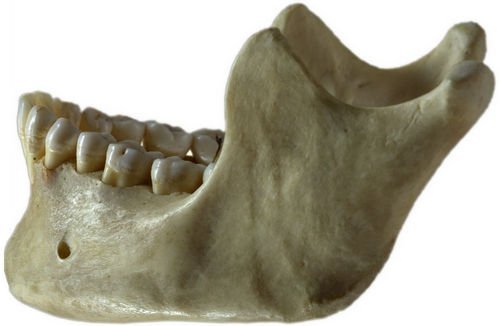 The jawbone holding the lower set of teeth image photo picture