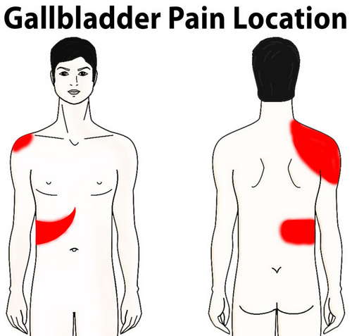 A diagram showing the areas where gallbladder pain can be felt image photo picture