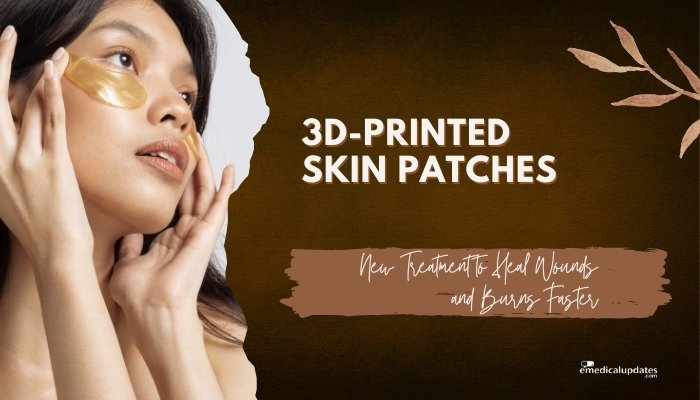3D-Printed Skin Patches- New Treatment to Heal Wounds and Burns Faster