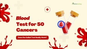 Blood Test for 50 Cancers- Does the Galleri Test Really Work?