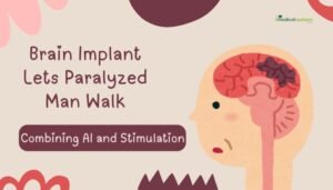 Brain Implant Lets Paralyzed Man Walk- Combining AI and Stimulation