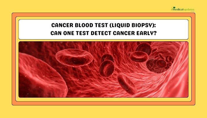 Cancer Blood Test (Liquid Biopsy)- Can One Test Detect Cancer Early?
