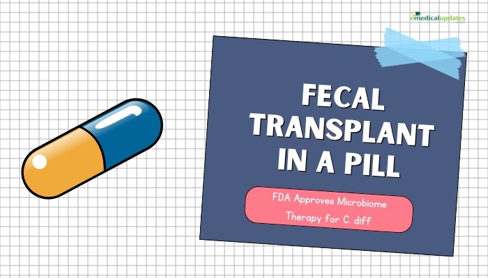 Fecal Transplant in a Pill- FDA Approves Microbiome Therapy for C. diff