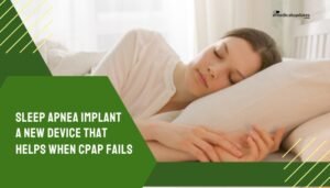 Sleep Apnea Implant- A New Device That Helps When CPAP Fails